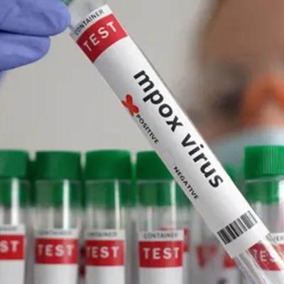 Mපොක්ස් ගැන සෞඛ්‍ය අමාත්‍යංශයෙන් නිවේදනයක්