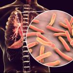 මෙරට 45%ක් ක්ෂය රෝගීන් බස්නාහිර පළාතෙන් - අවදානම් ස්ථාන එලියට