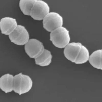 මාංශ භක්ෂක බැක්ටීරියා ආසාදනය ගැන මෙරටට පණිවිඩය​ක්